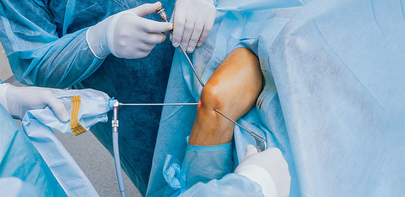 Arthroscopy for Sports Injury: Enhancing Recovery and Performance